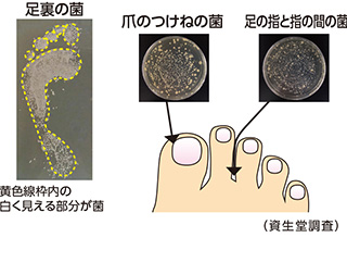 足裏の菌　爪のつけねの菌　足の指と指の間の菌（ファイントゥデイ調査）