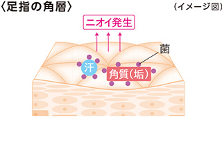 足裏はムレやすく、菌が多く、ニオイやすい
